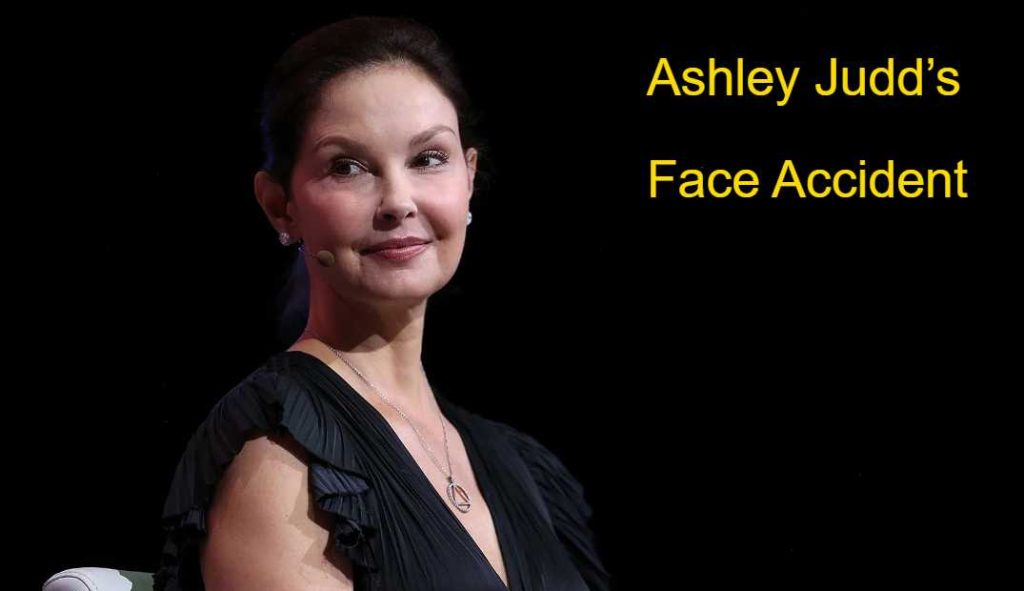 ashley judd face accident